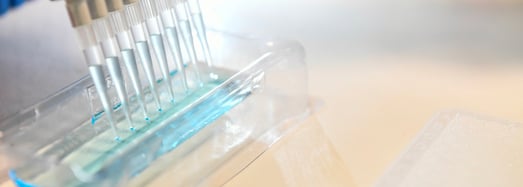 IRCCS Fatebenefratelli: schizofrenia e geni